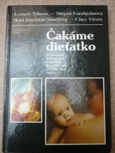 náhled knihy - čekáme dieťatko